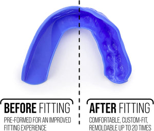 Sisu 3D Custom Fit Mouthguard